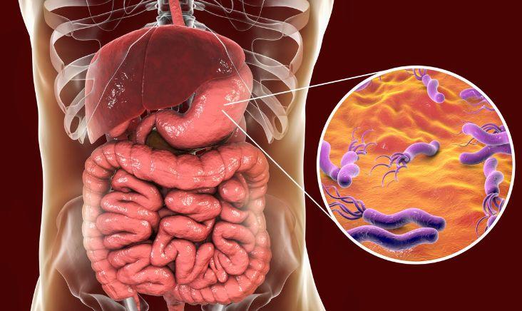 Helicobacter pylori (H. pylori) Infections Market is expected to reach $9.1 billion by 2034