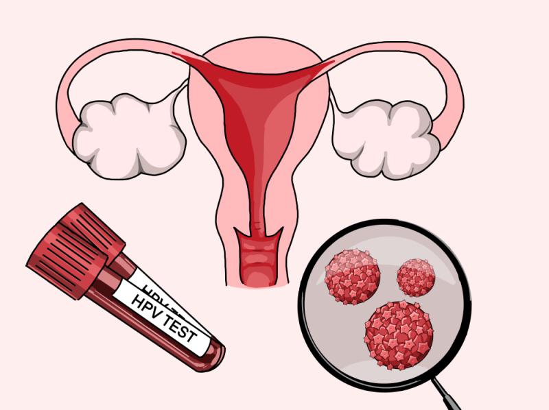 Human Papillomavirus 16 (HPV16) Positive Cancers Market is expected to reach USD 12.5 billion by 2034