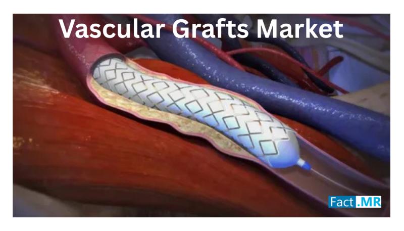 Vascular Grafts Market Valued at USD 4.23 Billion in 2025 | Medtronic PLC, Cook Medical, W.L. Gore & Associates Lead - Fact.MR