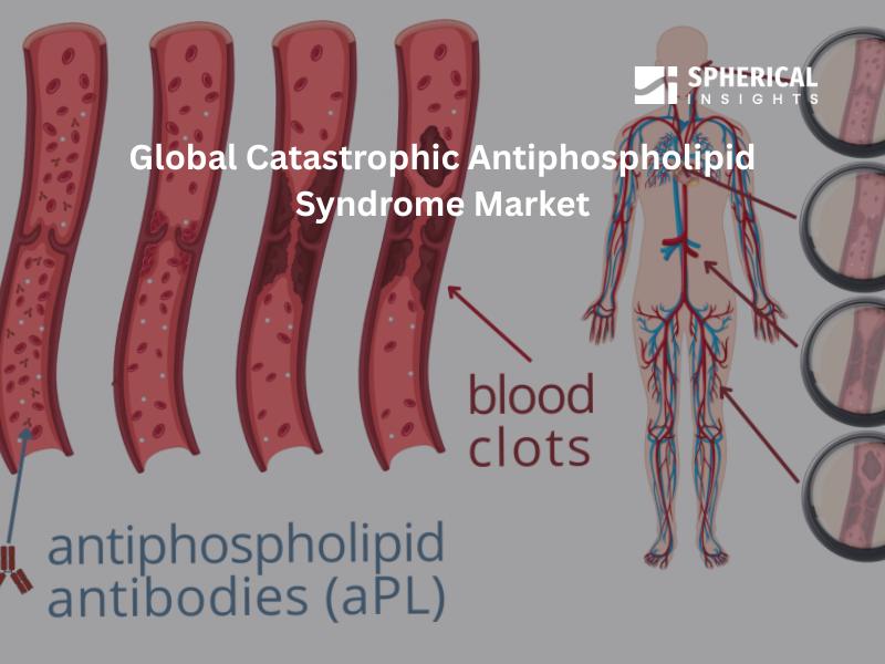 Global Catastrophic Antiphospholipid Syndrome Market Size, Share, Forecast 2023 - 2033 | Top key players : Pfizer, Abbott, Bristol-Myers Squibb Company, Eli Lilly and Company, Sanofi S.A, LGM Pharma, Taro Pharmaceuticals