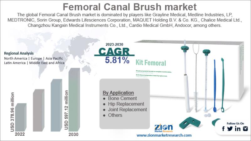 Femoral Canal Brush Market To Reach USD 597.1 Million By 2030, Growing At 5.81% CAGR