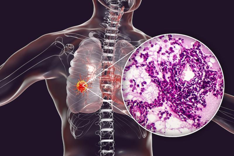 United States Cancer Biopsies Market Poised for Transformative Growth with Rising Demand for Early & Accurate Diagnosis 2025 | Leading key players - Hologic, Inc., Biocept, Inc., Danaher.