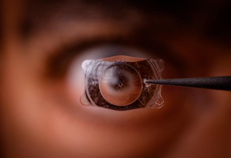 Implantable Collamer Lens Market Trends and Insights 2024-2031: Advancements in Biocompatible Lenses, Reversibility, and Alternatives to LASIK Surgery