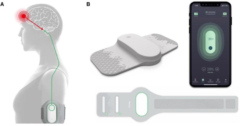 Neuromodulation Devices Market is expected to reach USD 24 billion by 2034