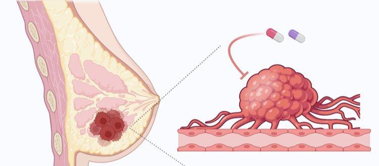 United States Breast Cancer Drugs Market Set for Strong Growth as Breakthrough Therapies and Rising Awareness Drive Global Demand 2025 | Major key players - Novartis AG, F. Hoffmann-La Roche Ltd., AbbVie, Inc.