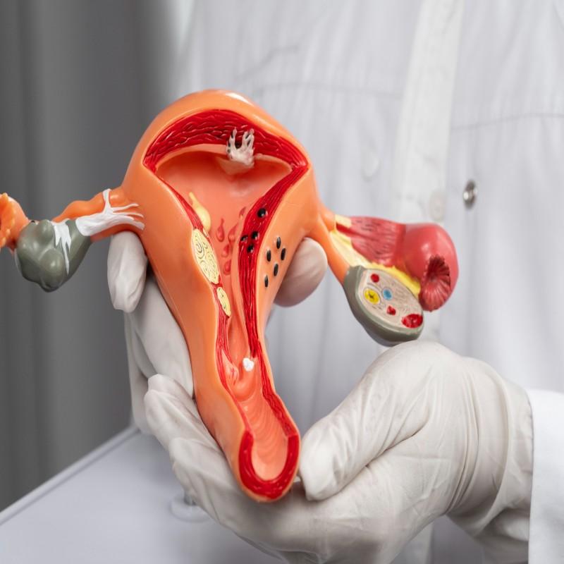 United States Medical Cervical Cancer Diagnostics Market 2025 | Growth Drivers, Key Players & Investment Opportunities