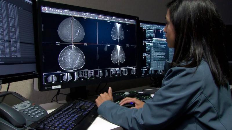 United States Molecular Breast Imaging Market Set for Breakthrough Growth with Rising Demand for Early Cancer Detection 2025 | Top key players - CMR Naviscan Corporation, SmartBreast Corporation.