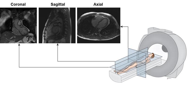 United States Cardiac MRI Testing Market to Grow Rapidly by 2033, Driven by Advanced Diagnostic Imaging & Cardiovascular Screening | Key Players: Koninklijke Philips N.V, FUJIFILM Corporation, Canon Inc., NeoSoft LLC, Siemens Healthcare Private Limited