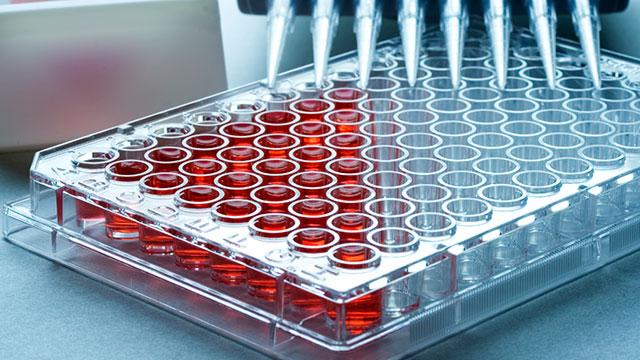Microplate Systems Market Is Booming So Rapidly | Thermo Fisher