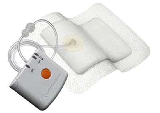 The Global Single Use Negative Pressure Wound Therapy (NPWT) Devices Market is projected to reach a market size of $1,857.26 million by 2030.