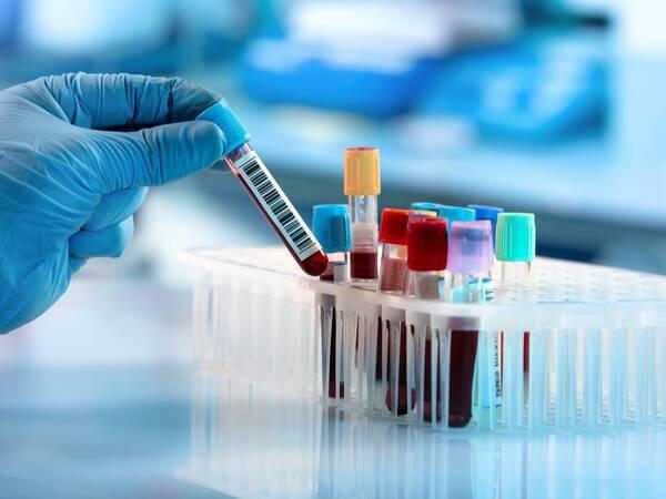 Blood Screening Market Outlook and Future Growth Trends