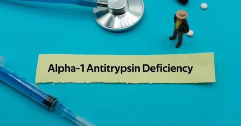 United States Alpha-1 Antitrypsin (AAT) Deficiency Market Intelligence 2025: Poised for Massive Growth Through 2032 | Most Leading Companies - Grifols, CSL Behring LLC, and Takeda Pharmaceutical Company Limited