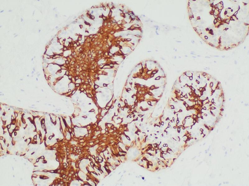 Immunohistochemistry Market size is estimated to reach US$4,240.65 million by 2031, growing at a CAGR of 8.1% | Top Companies are Danaher Corporation, F. Hoffmann-La Roche Ag., BD, Agilent Technologies, Inc.