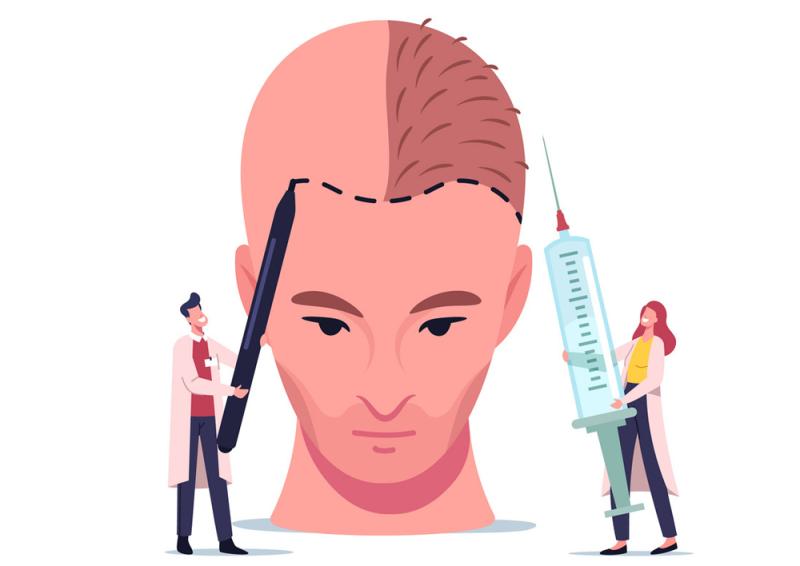 Hair Transplant Market