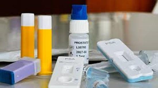 Global Prostate Cancer Testing Kits Market is projected to reach the value of $7.74 Billion by 2030.