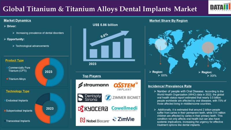 United States Titanium & Titanium Alloys Dental Implants Market 2025 | Growth Drivers, Competitive Landscape & Business Opportunities