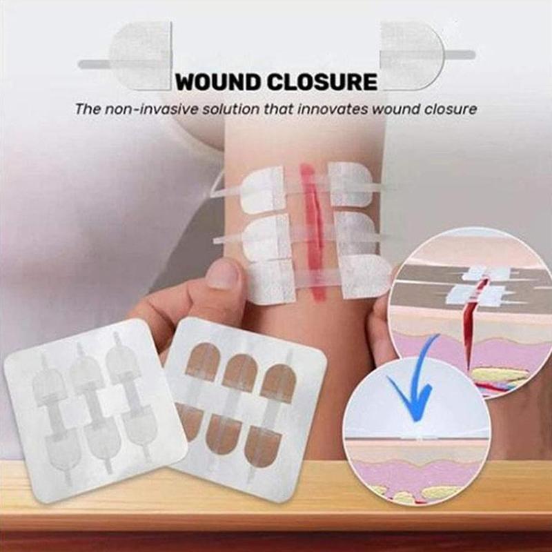 United States Wound Closure Products Market to Reach US$41.76 Billion by 2033 Driven by Rising Surgeries and Technological Innovations