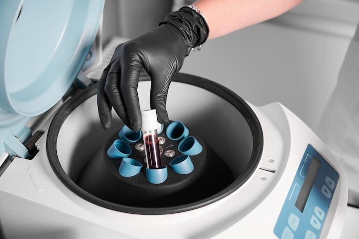 Blood Plasma Separators Market Worth Observing Growth | Market IntelliX