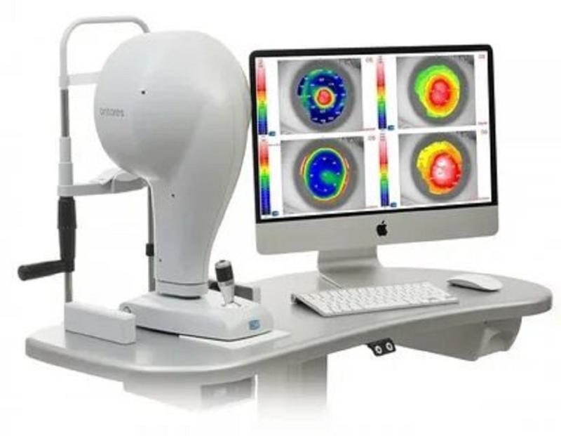 US Corneal Topographers Market Trends 2025 Highlight AI Integration and OCT-Based Diagnostic Innovations