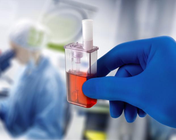 United States Micro Bioreactor Market | Strategic Investments & Key Industry Collaborations