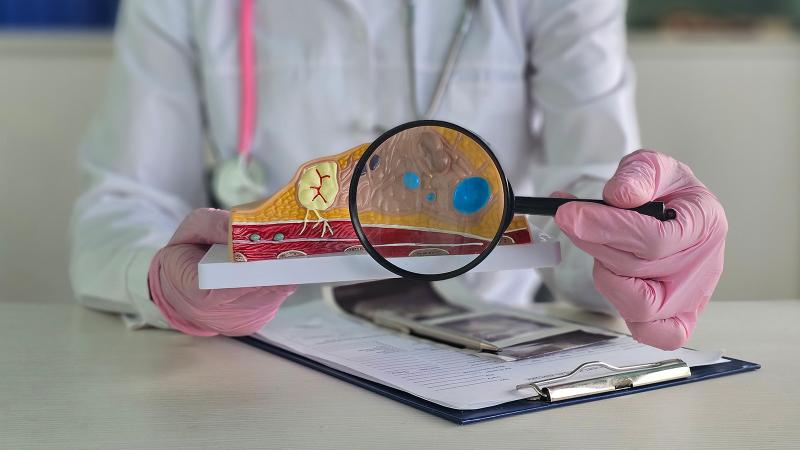 United States Breast Cyst Treatment Market Poised for Major Growth, Ultrasound-Guided Therapies & Drug Developments | Global Companies - Advin Health Care, Becton, Dickinson, and Company, Swastik Enterprise, Argon Medical Devices, Inc