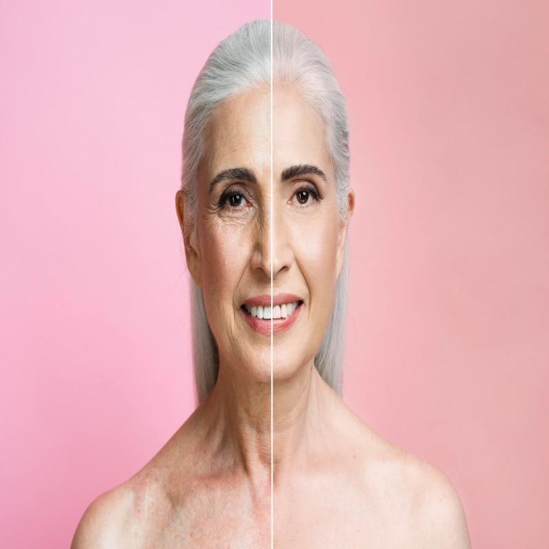 United States Anti Aging Market 2025 | Growth Drivers, Key Players & Investment Opportunities