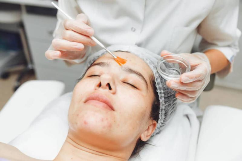 United States Chemical Peel Market to hit US$2.22 Billion By 2033 | Top Most Keyplayers - Galderma S.A., Bausch Health Companies Inc., Merz Pharma GmbH & Co. KGaA, L'Oreal