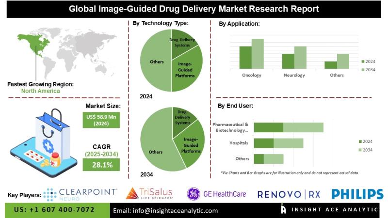 Image-Guided Drug Delivery Market Drivers Include Technological Advancements Rising Healthcare Investments and Awareness