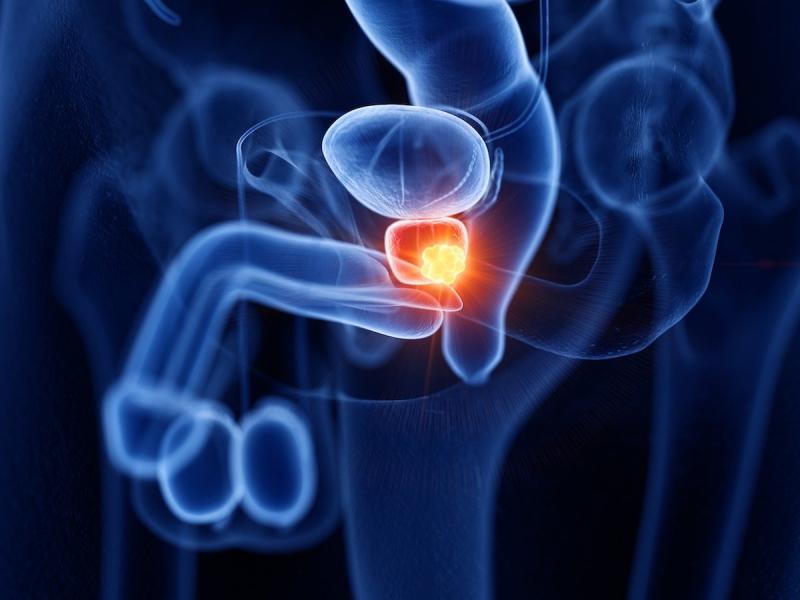 Japan Prostate Cancer Imaging Market 2025: Industry Developments, Future Growth & Market Insights | GE Healthcare, Siemens Healthineers, Philips