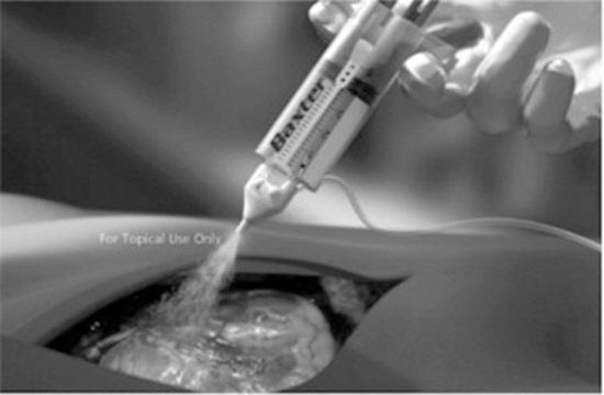 The Global Tissue Sealants and Tissue Adhesives Market is projected to reach a market size of $4.38 billion by 2030.
