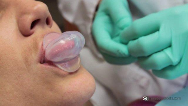 Tongue Retaining Device Market Seeking Excellent Growth | Market IntelliX