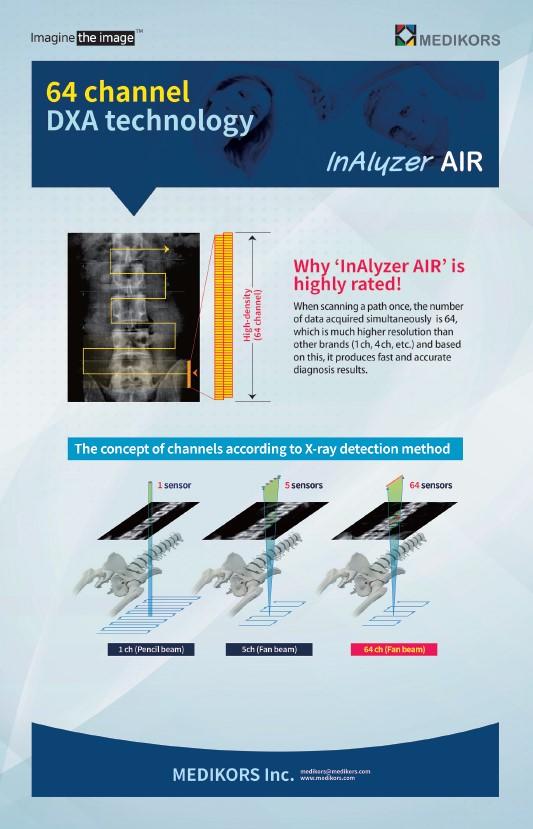 Advanced Bone Mineral Density Measurement Technology Device InAlyzer AIR | MEDIKORS