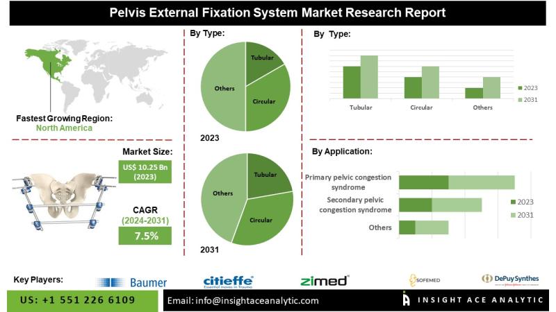 Pelvis External Fixation System Market Boosted by Rising Adoption in Trauma Care and Orthopedic Treatments