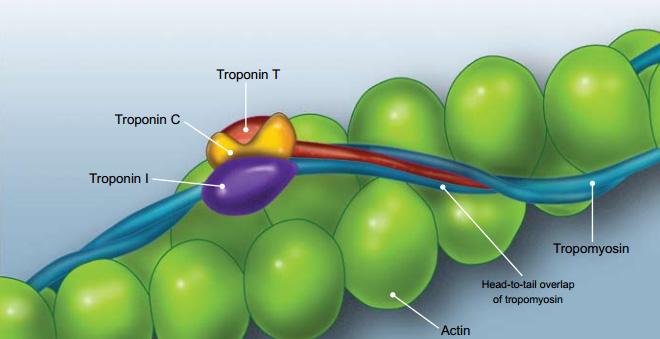 Cardiac Troponin Industry Lucrative Growth 2025 | Top 5 Companies - Fujirebio, LifeSign, Alere, and Singulex, Beckman Coulter