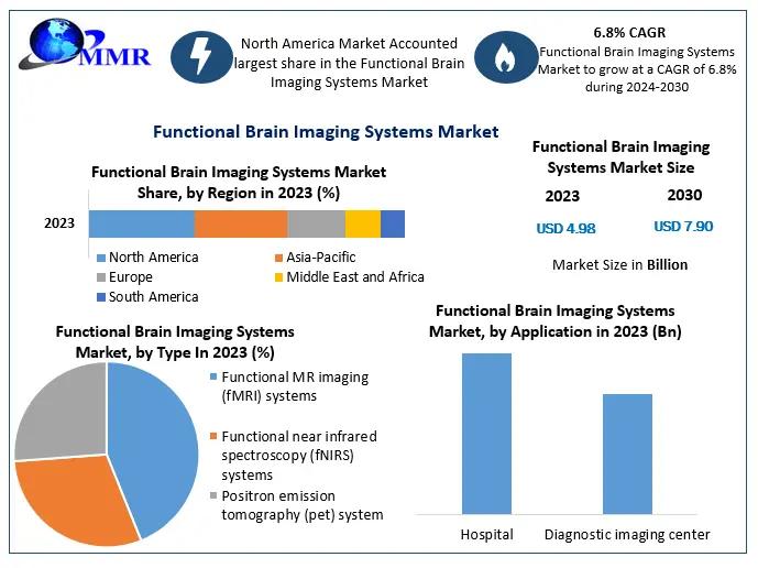 Functional Brain Imaging Systems Market Key Trends, Opportunities, Revenue Analysis, Sales Revenue