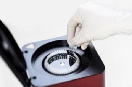 Global Sanger-based Diagnostics Testing Market is projected