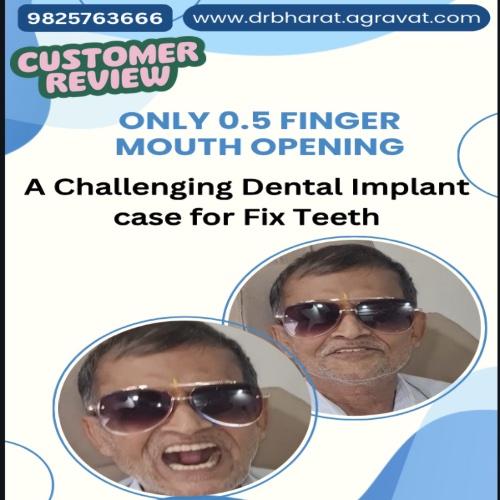 Transformative Mouth Opening to Fixed Teeth Journey: Mr. Shah's Inspiring Story of OLI Therapy and Dental Implants by Dr. Bharat