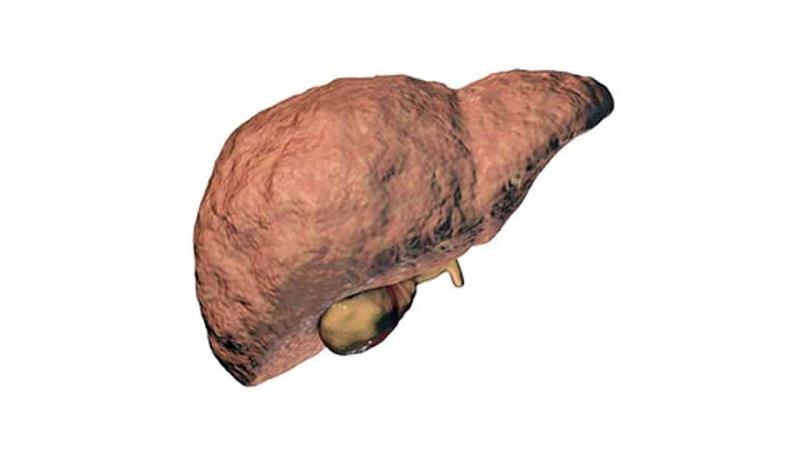 Liver Fibrosis Patient Pool Analysis