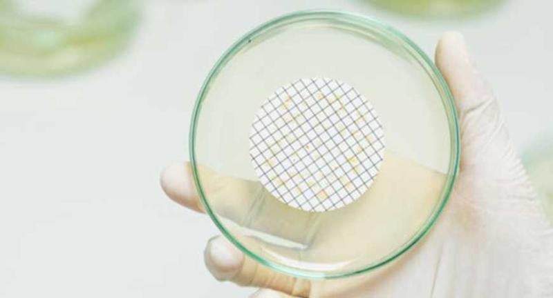 Global Medical Membrane Market is Projected to Reach USD 3.84