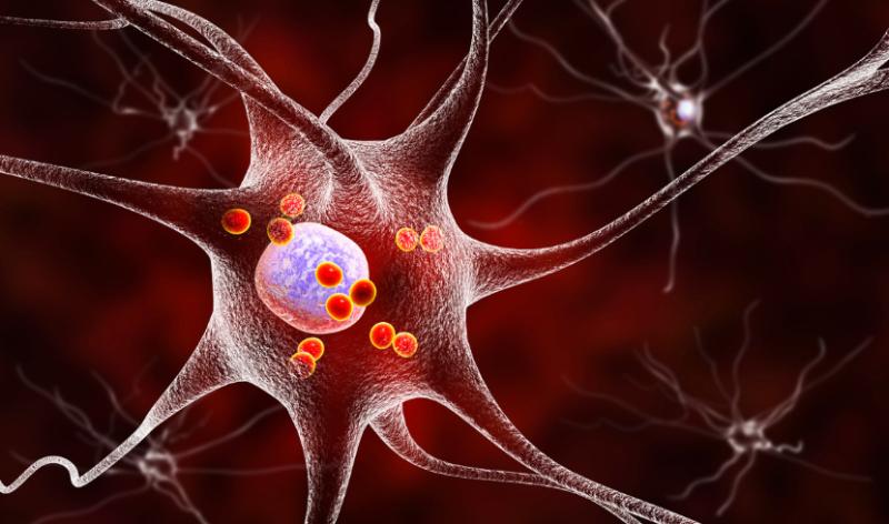 Multiple Sclerosis Treatment Market Forecast: Growth to USD