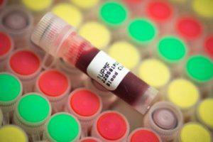 Biobanking Market 2016 to grow at a CAGR of 7.07% during the period