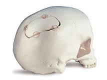 United Kingdom Cranio Maxillofacial Fixation