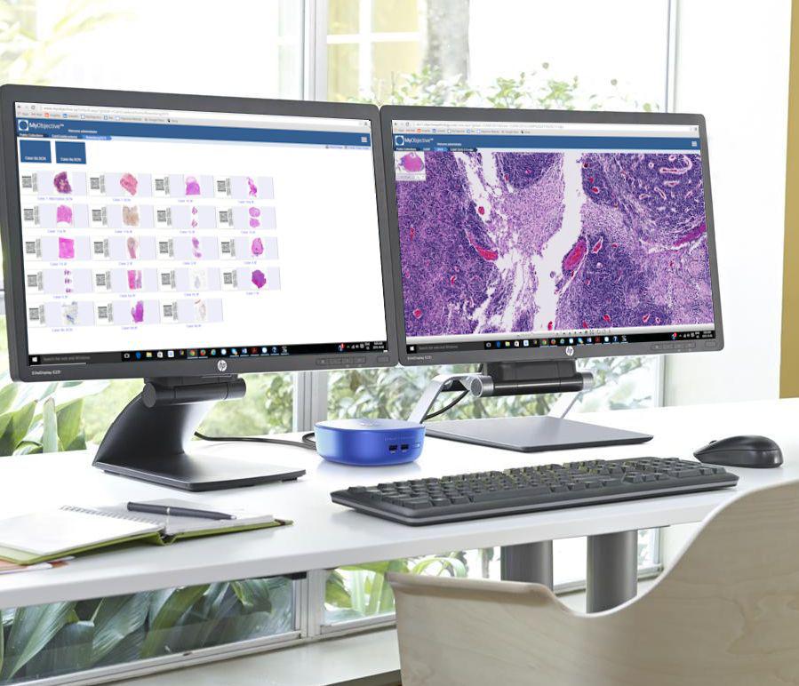 Objective Pathology Brings Affordable Digital Pathology to