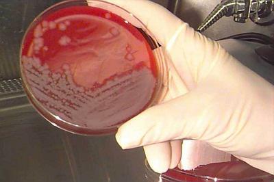 Microbiology Culture Market : Efficient Diagnosis Method