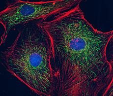 Cellular Imaging Market, Cellular Imaging, microscopy market, microscopy, Imaging computer programming
