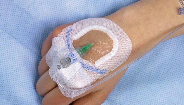 Peripheral Intravenous Catheters Market, Peripheral Intravenous Catheters, Intravenous Catheters, Intravenous Catheters Market