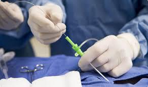Global Minimally Invasive Surgery Market