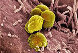 Gonorrhea Diagnostic Market — Global Industry Insights, Trends, Outlook, and Opportunity Analysis, 2016–2024