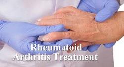 Rheumatoid Arthritis Treatment Market - Revolutionizing The Pharmaceutical Industry