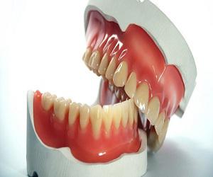 Dental Prosthesis Market